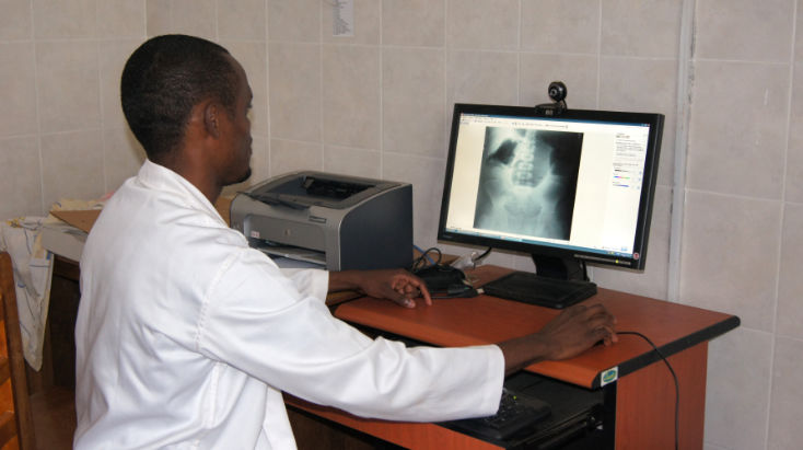 Doctor mirando radiografía en Camerún